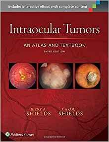 Intraocular Tumors  2015 - چشم